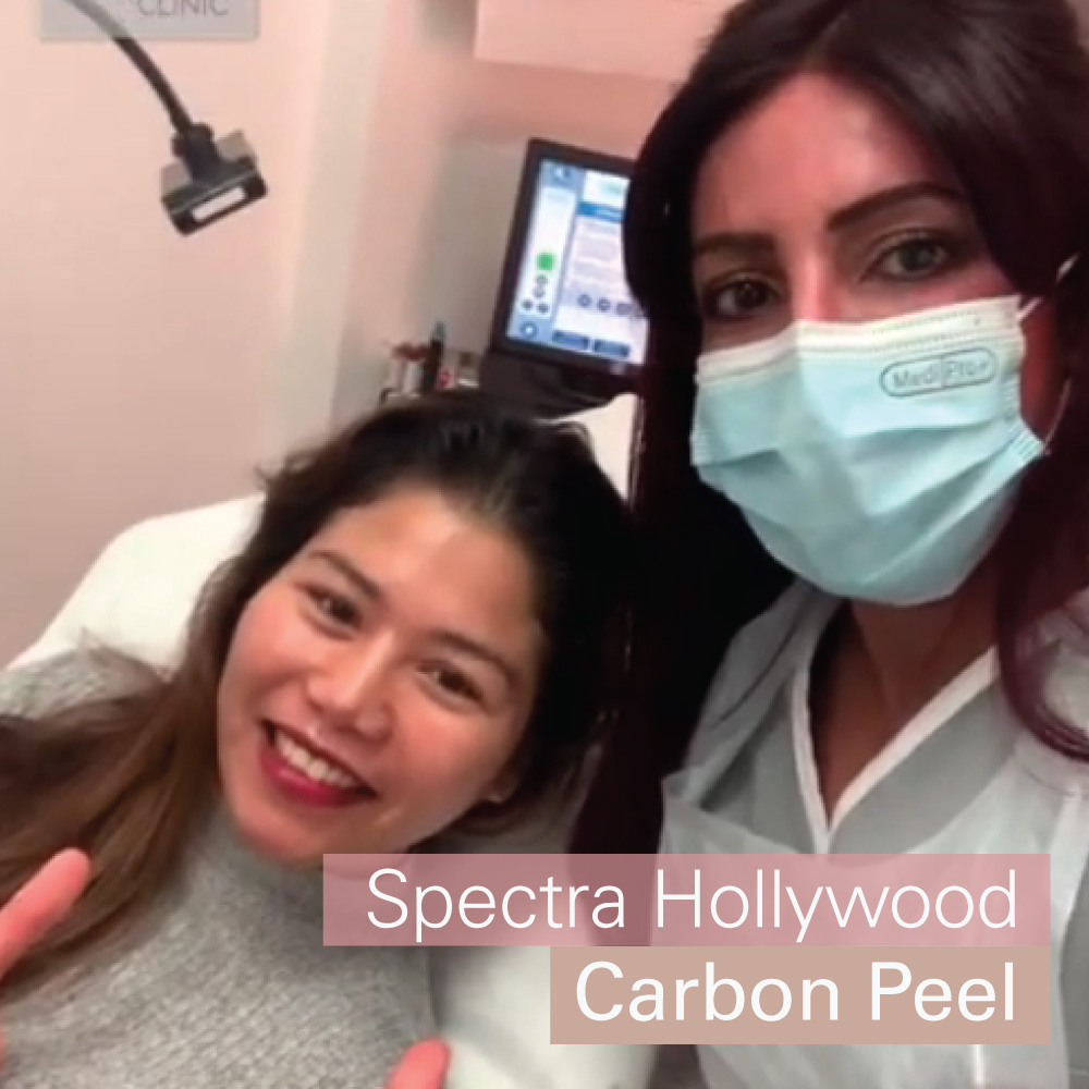 Spectra Hollywood Peel
